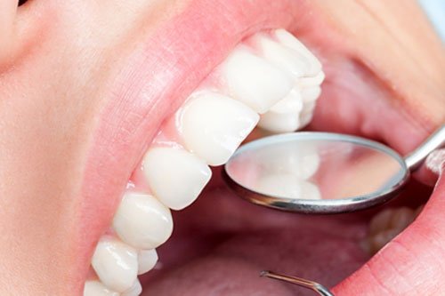 general-dentistry-blog-img