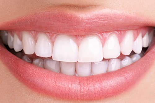 teeth-whitening-blogimg