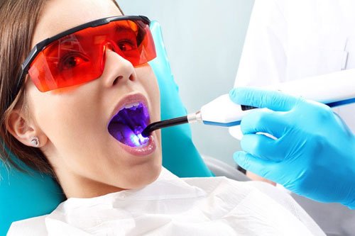 Laser-Dentistry