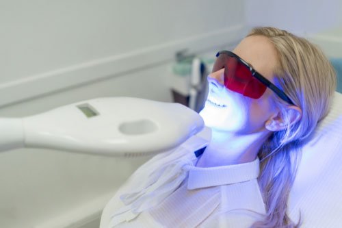Best Teeth Whitening Treatment in Baulkham Hills